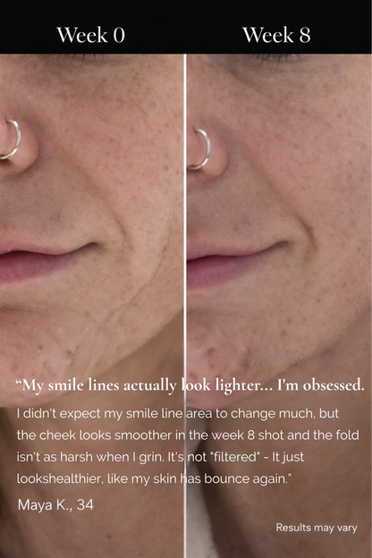 DermaLume™ Deepcare+ Serum-Infused Micro Dart Patches