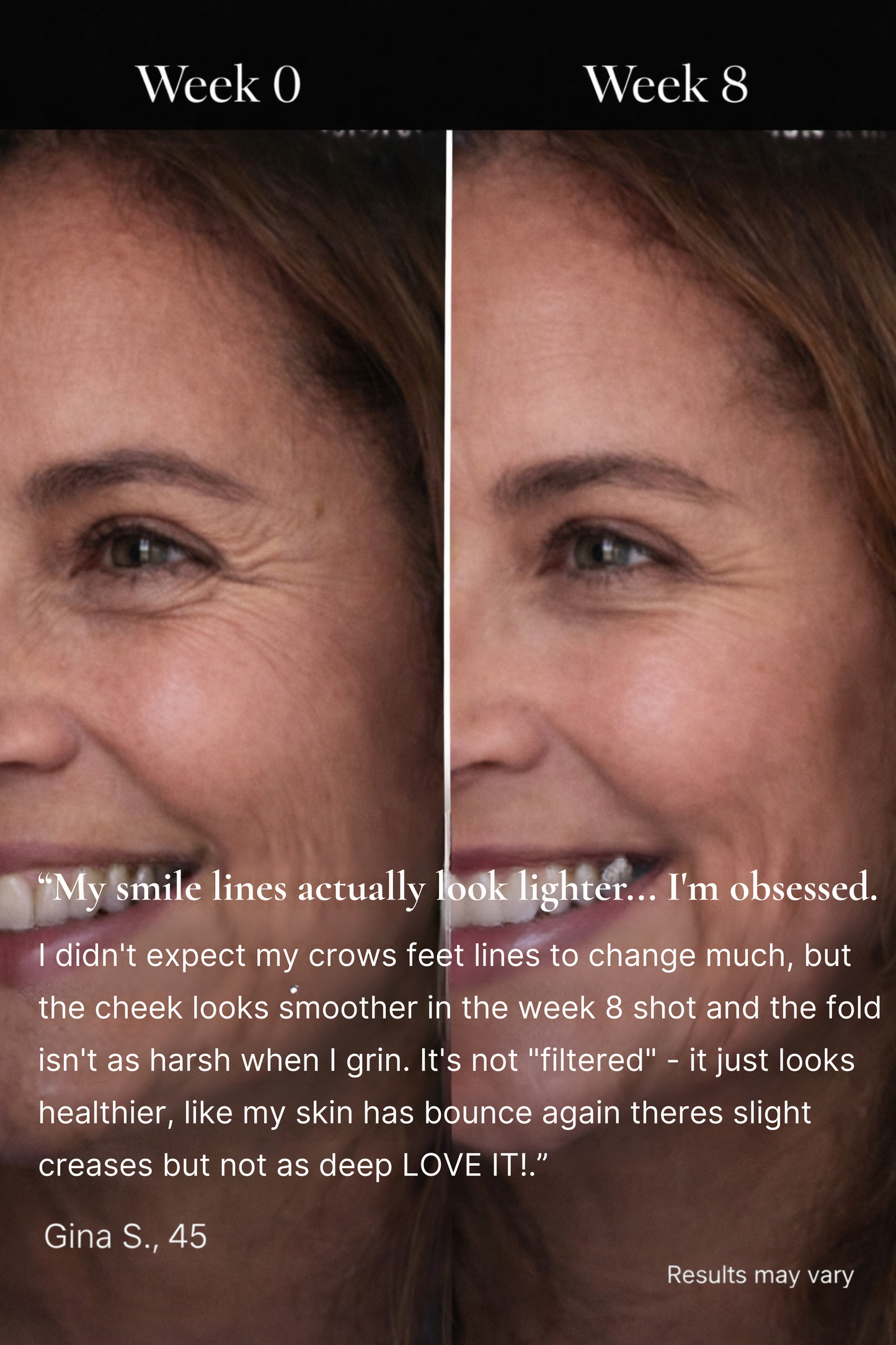 DermaLume™ Deepcare+ Serum-Infused Micro Dart Patches