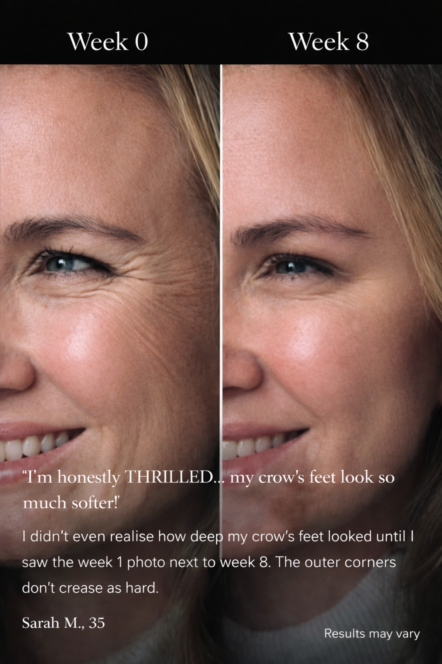 DermaLume™ Deepcare+ Serum-Infused Micro Dart Patches